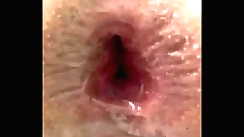 Expulsando uma maçã grande execute cu, porque sou arrombada e larga