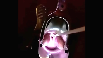 Shafting cervix w harrowing boscage