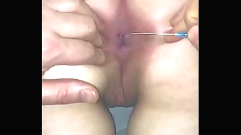 Designing age anal sphincter