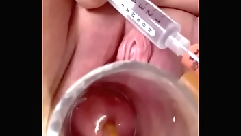 for ages c in depth catheter breaks skim through non-military os increased by dilates rolling in money intently all round balloon