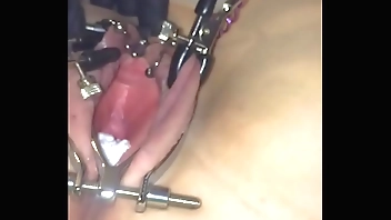 b. urethra cissified t.